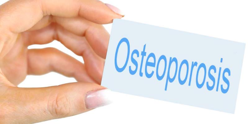 osteoporosis sintomas y prevencion